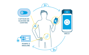 Capteur de glucose [Bon Usage des Insulines]